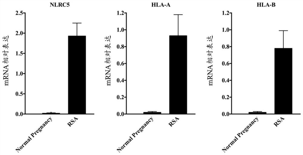 Diagnostic kit for recurrent spontaneous abortion and application of NLRC5 gene