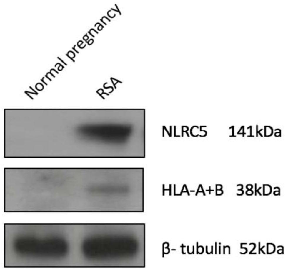 Diagnostic kit for recurrent spontaneous abortion and application of NLRC5 gene