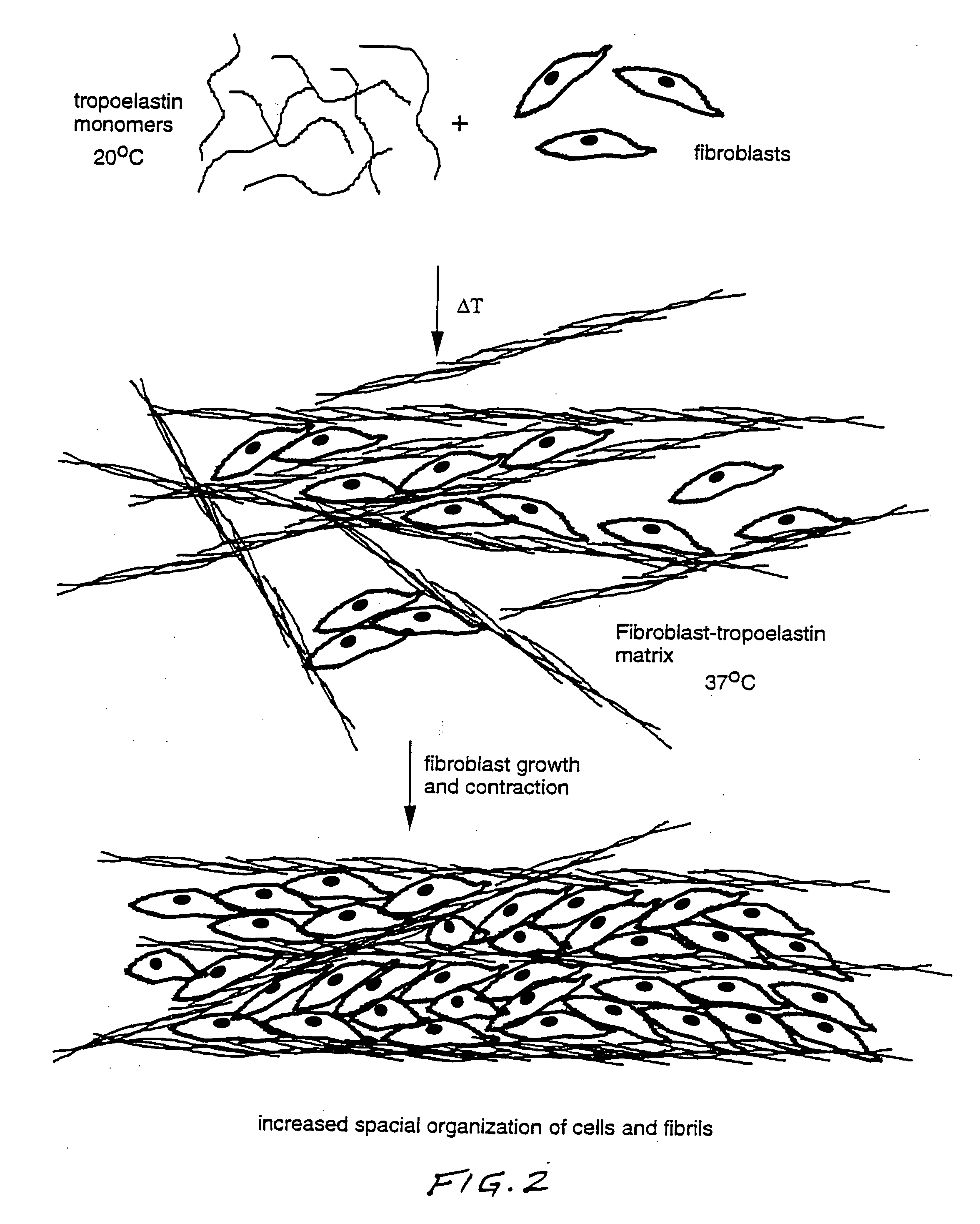 Method for using tropoelastin and for producing tropoelastin biomaterials