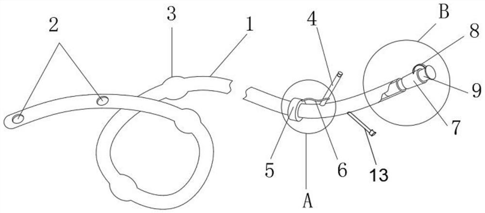 Internal fixation stomach tube capable of preventing regurgitation and aspiration