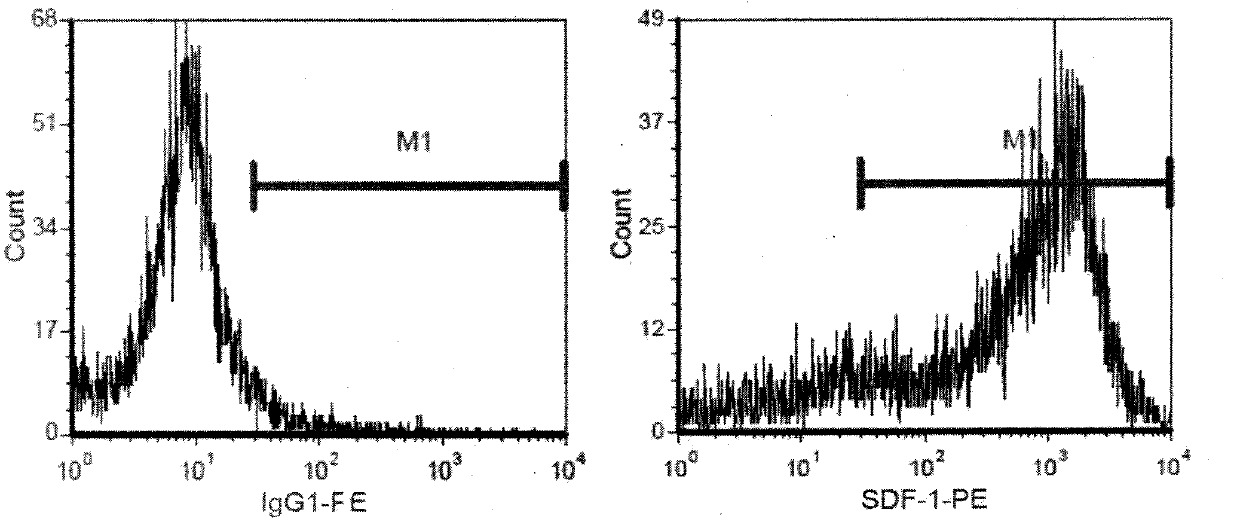 Biological beautifying preparation containing autologous stroma cells