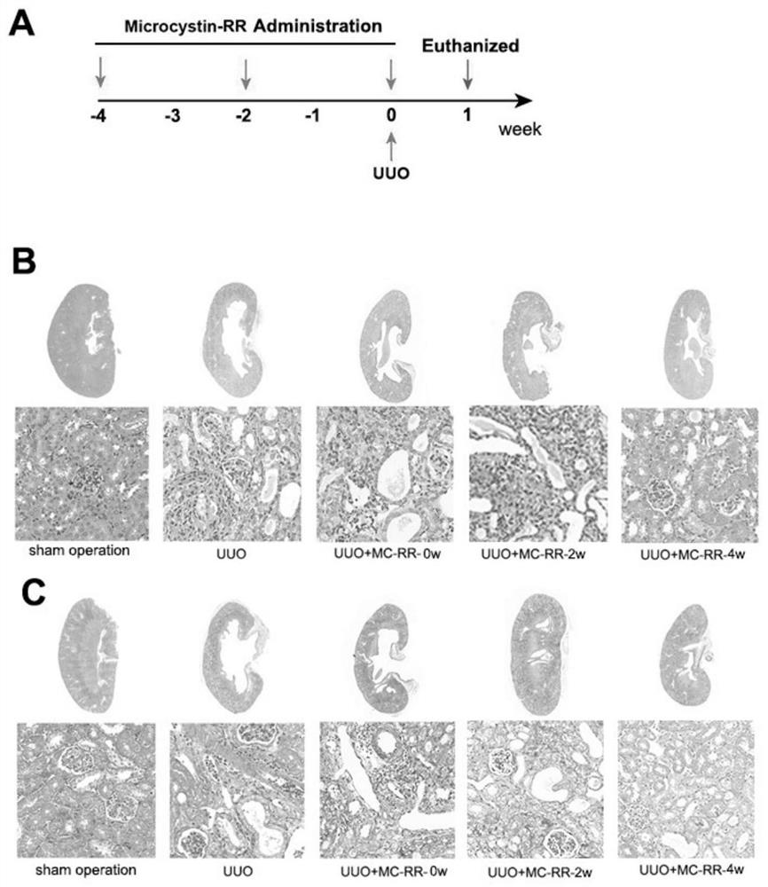 Use of microcystin-RR in preparing drugs for preventing or treating renal fibrosis diseases