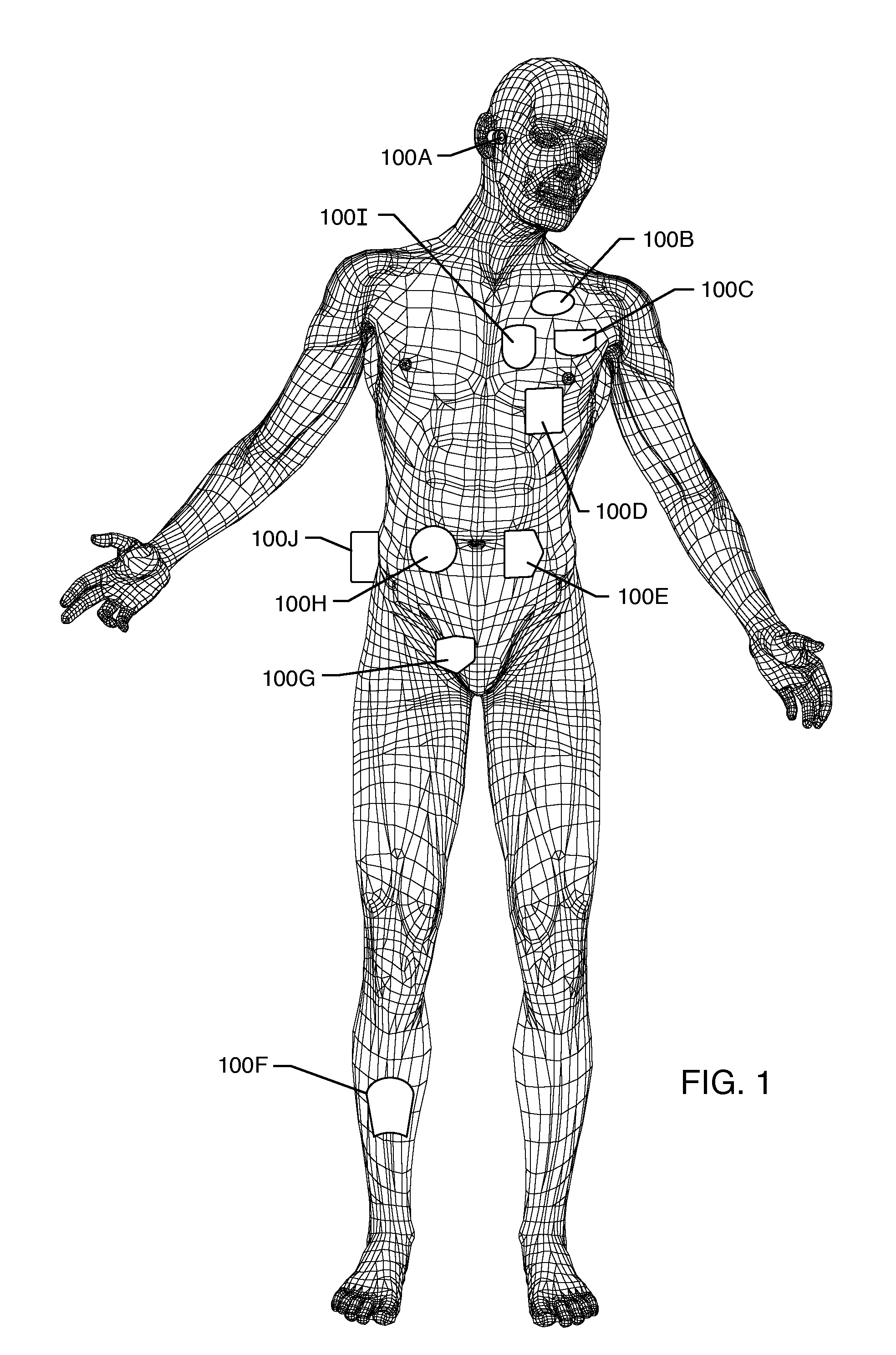 RF filter for an active medical device (AMD) for handling high RF power induced in an associated implanted lead from an external RF field