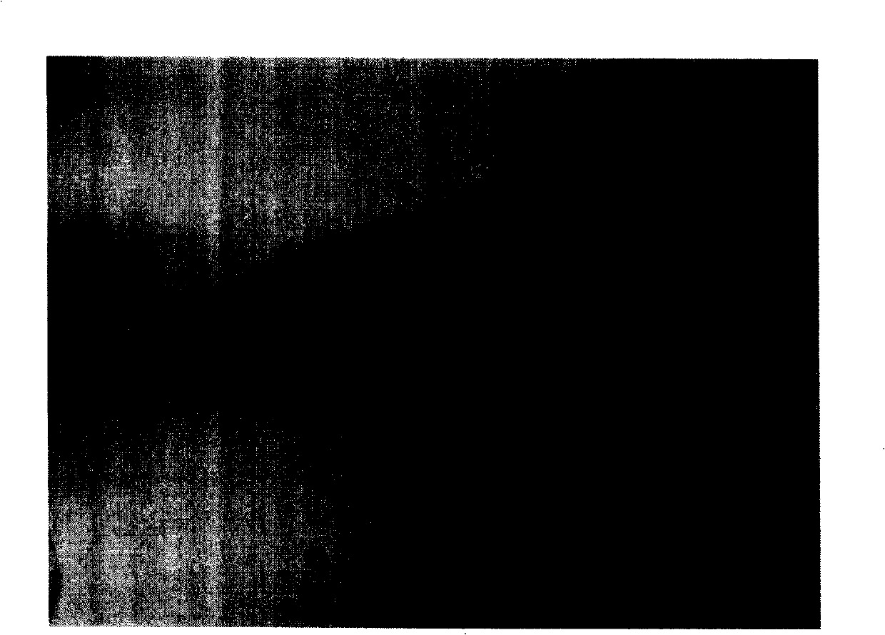 Potentiator for radiation therapy comprising pyridine derivative as active ingredient