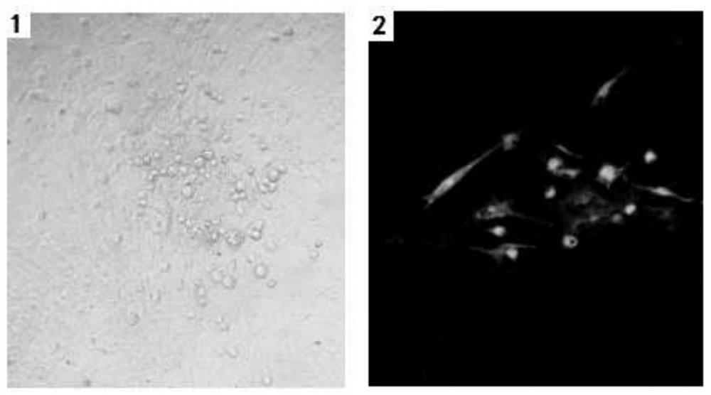 Construction and application of recombinant Marek's disease virus MDLV21 strain