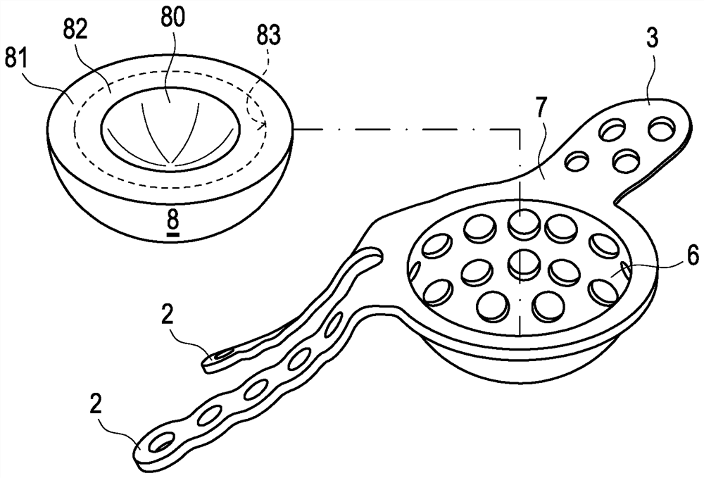 Hip joint implant with reshapeable fastening brackets