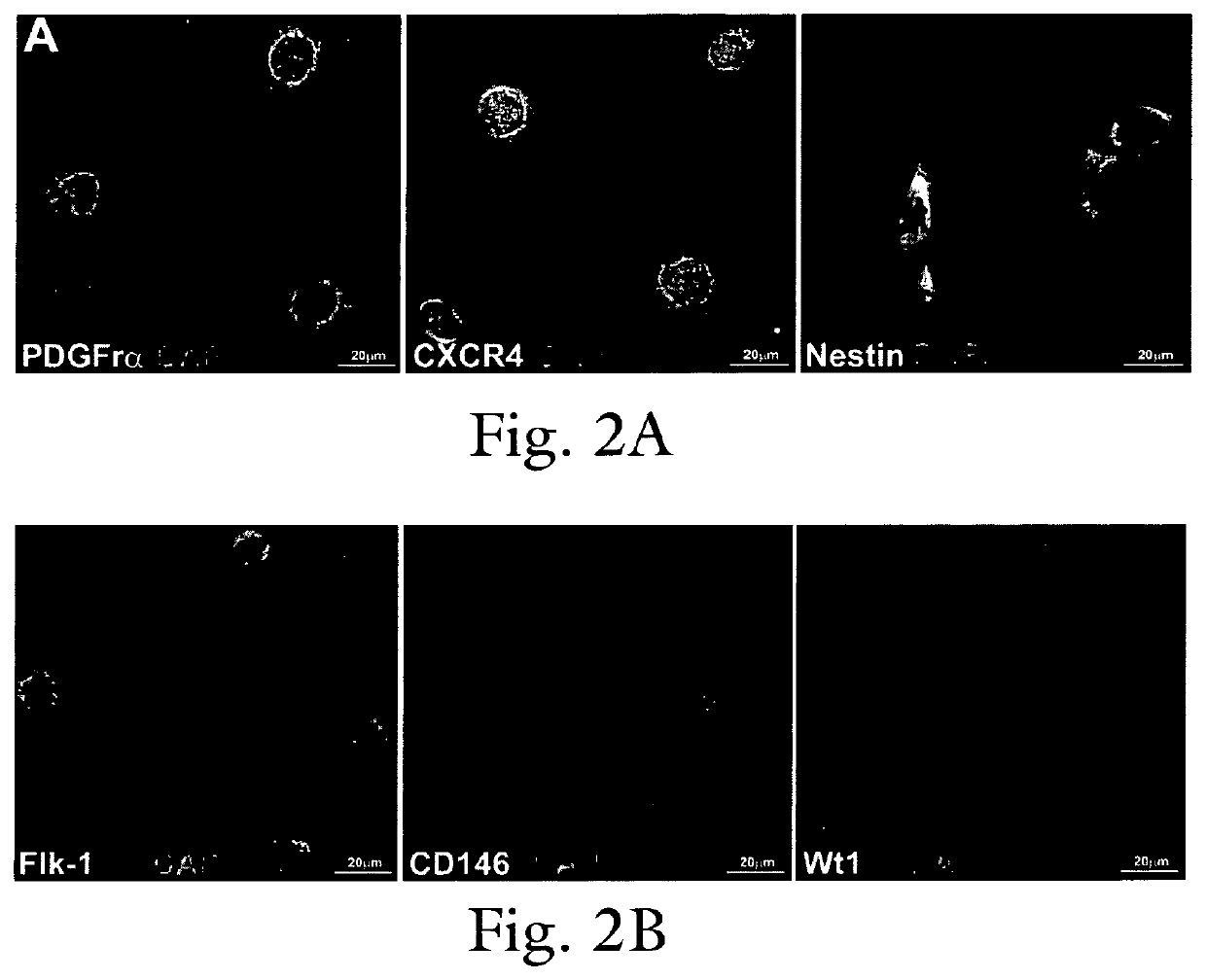 Modulation of cardiac stem-progenitor cell differentiation, assays and uses thereof