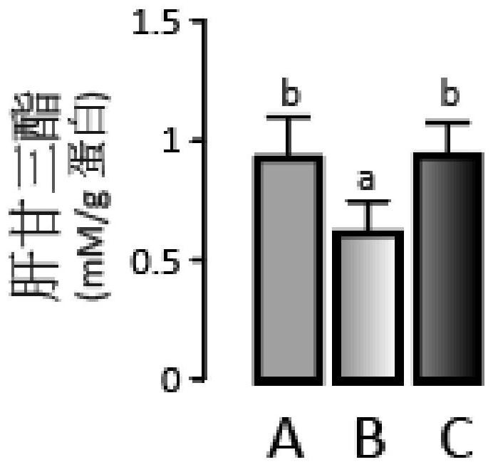 Application of cholesterol ester synthase ACAT1 inhibitor in preparation of medicine for preventing/treating non-alcoholic fatty liver disease