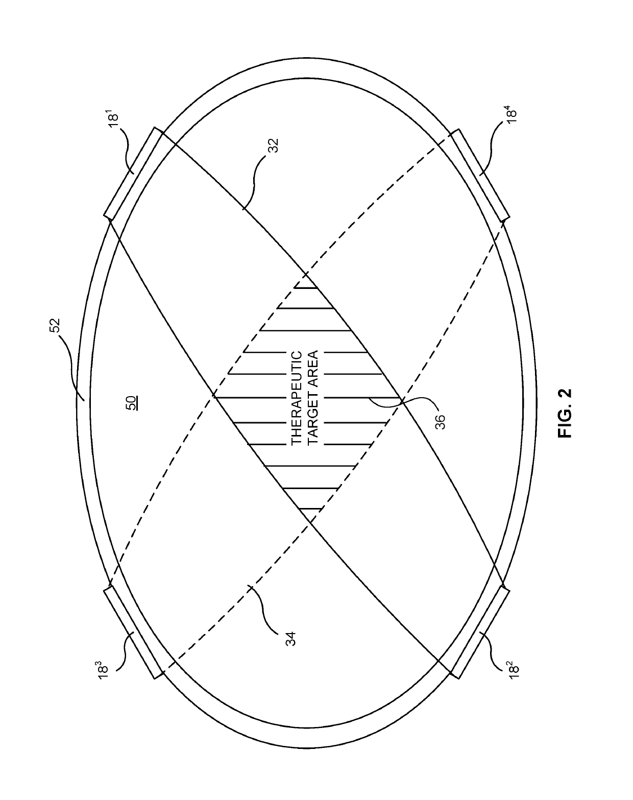 Medical cuff employing electrical stimulation to control blood flow