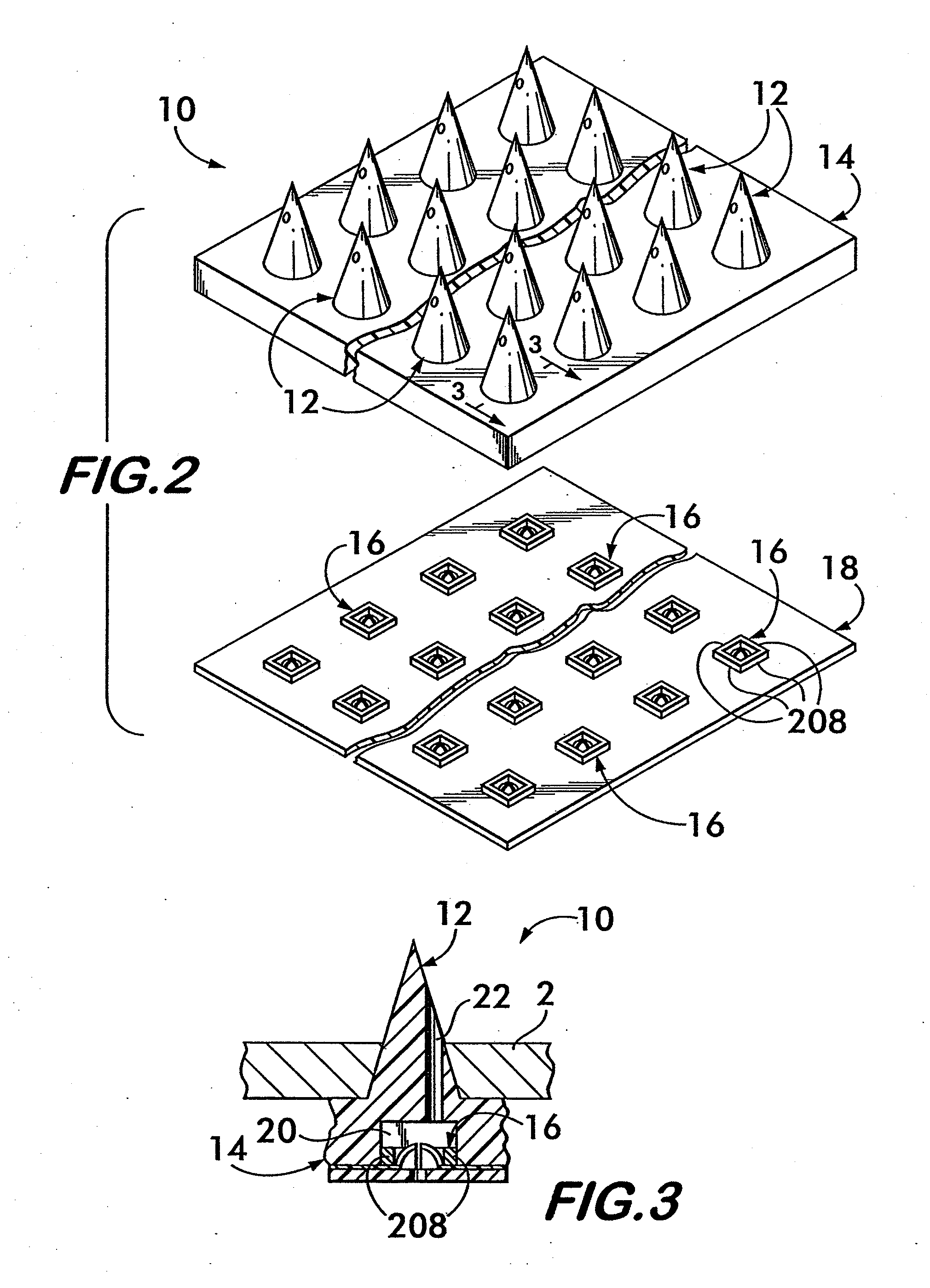 Implantable micro-system for treatment of hydrocephalus