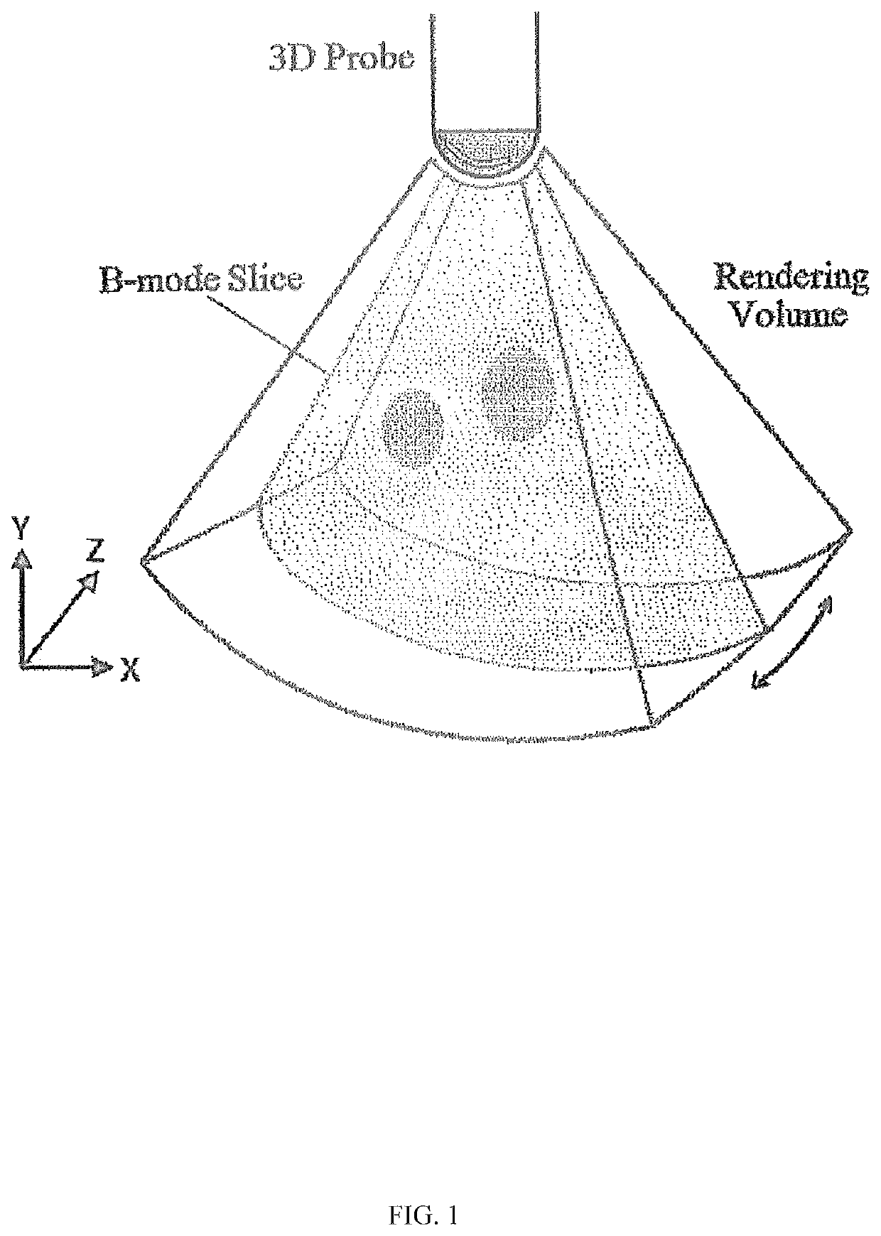 System and device for tumor characterization using nonlinear elastography imaging