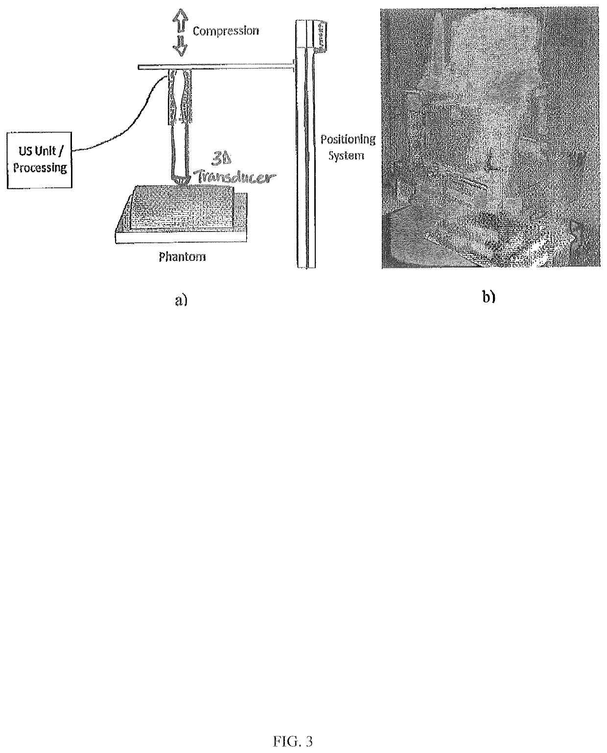 System and device for tumor characterization using nonlinear elastography imaging