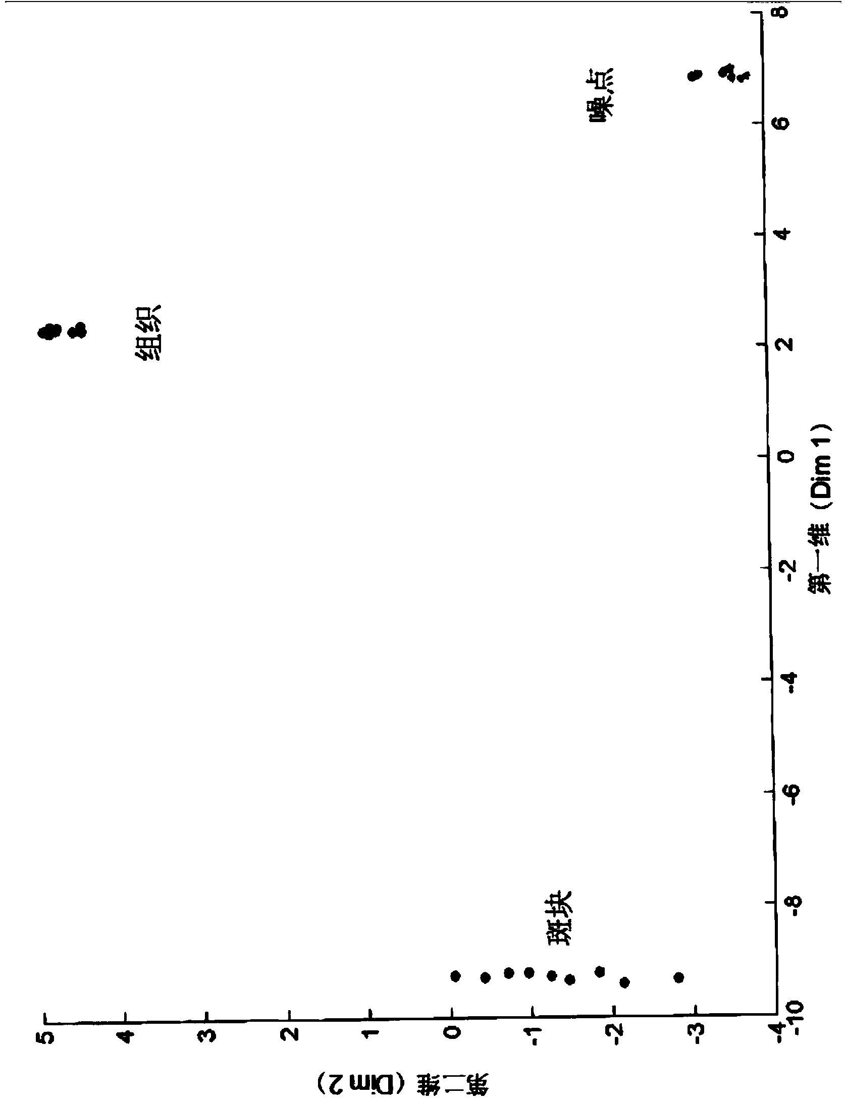 A method and system of characterization of carotid plaque