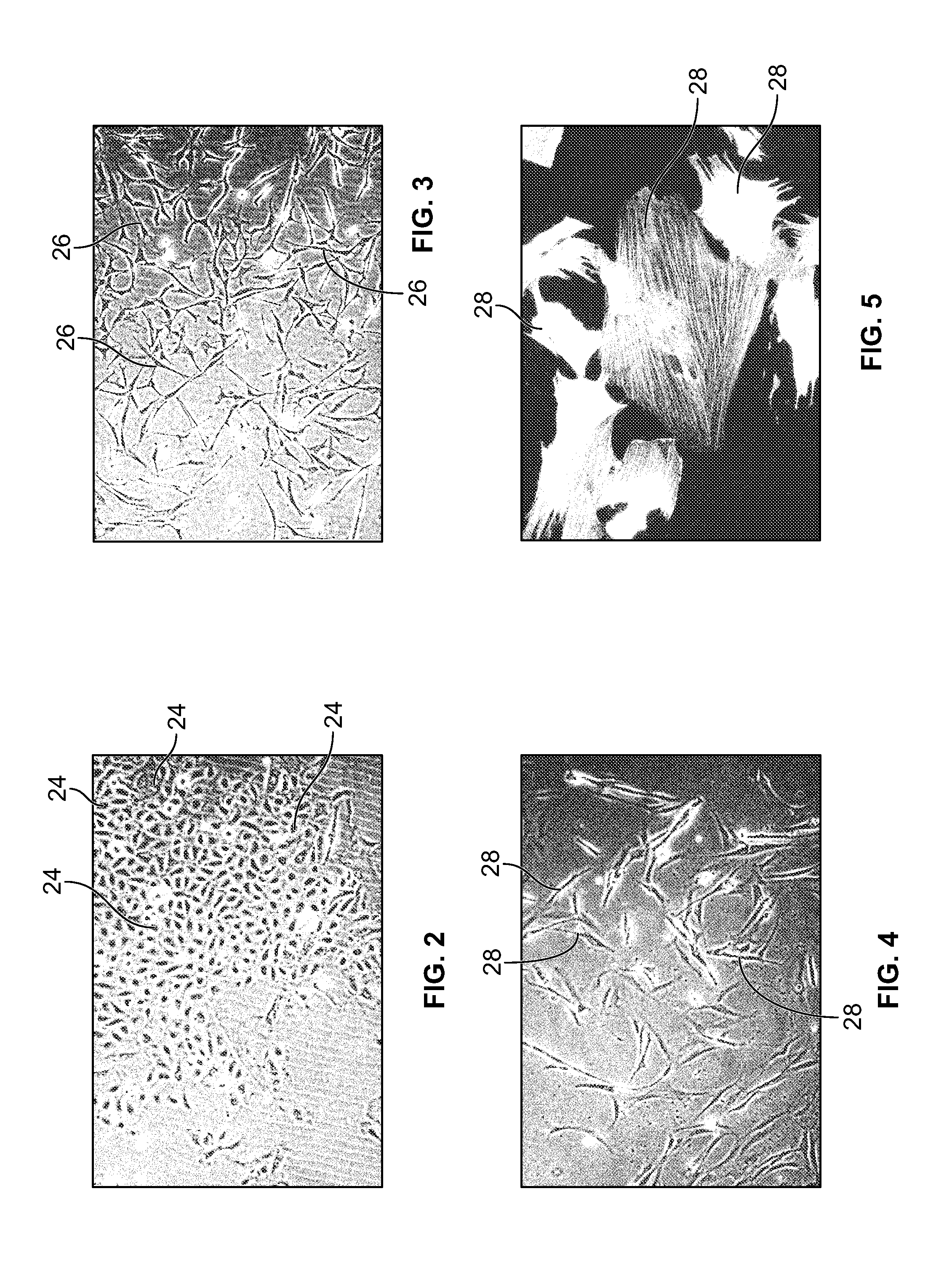 Creation of hair follicles in tissue-engineered skin grafts