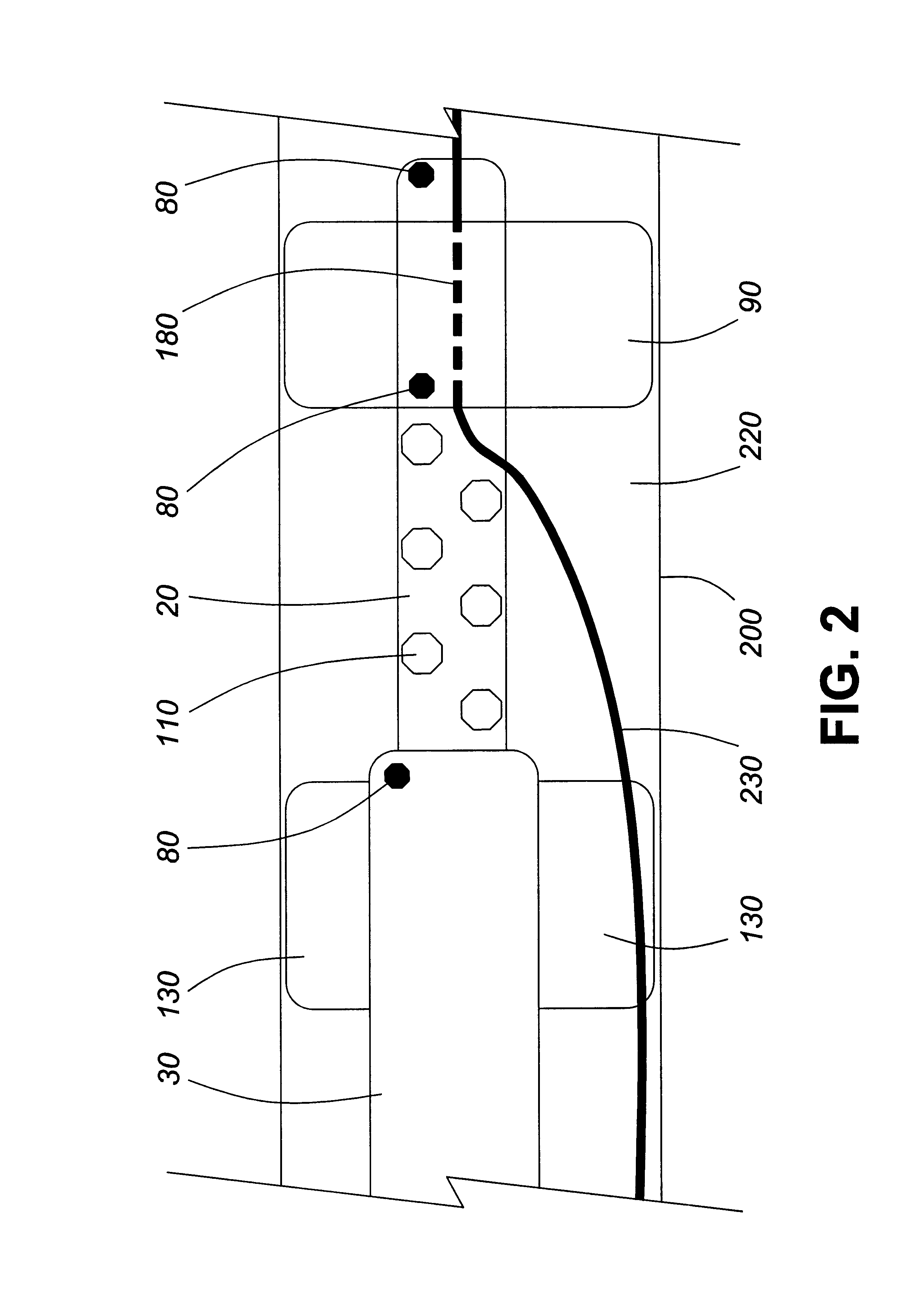 Adjustable multi-balloon local delivery device