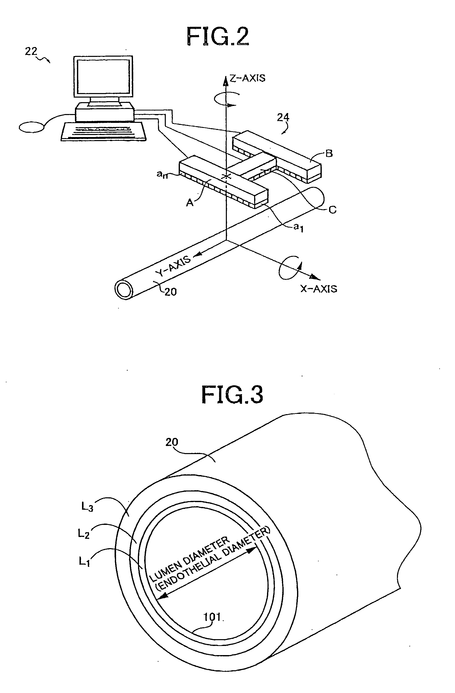 Blood vessel ultrasonic image measuring method