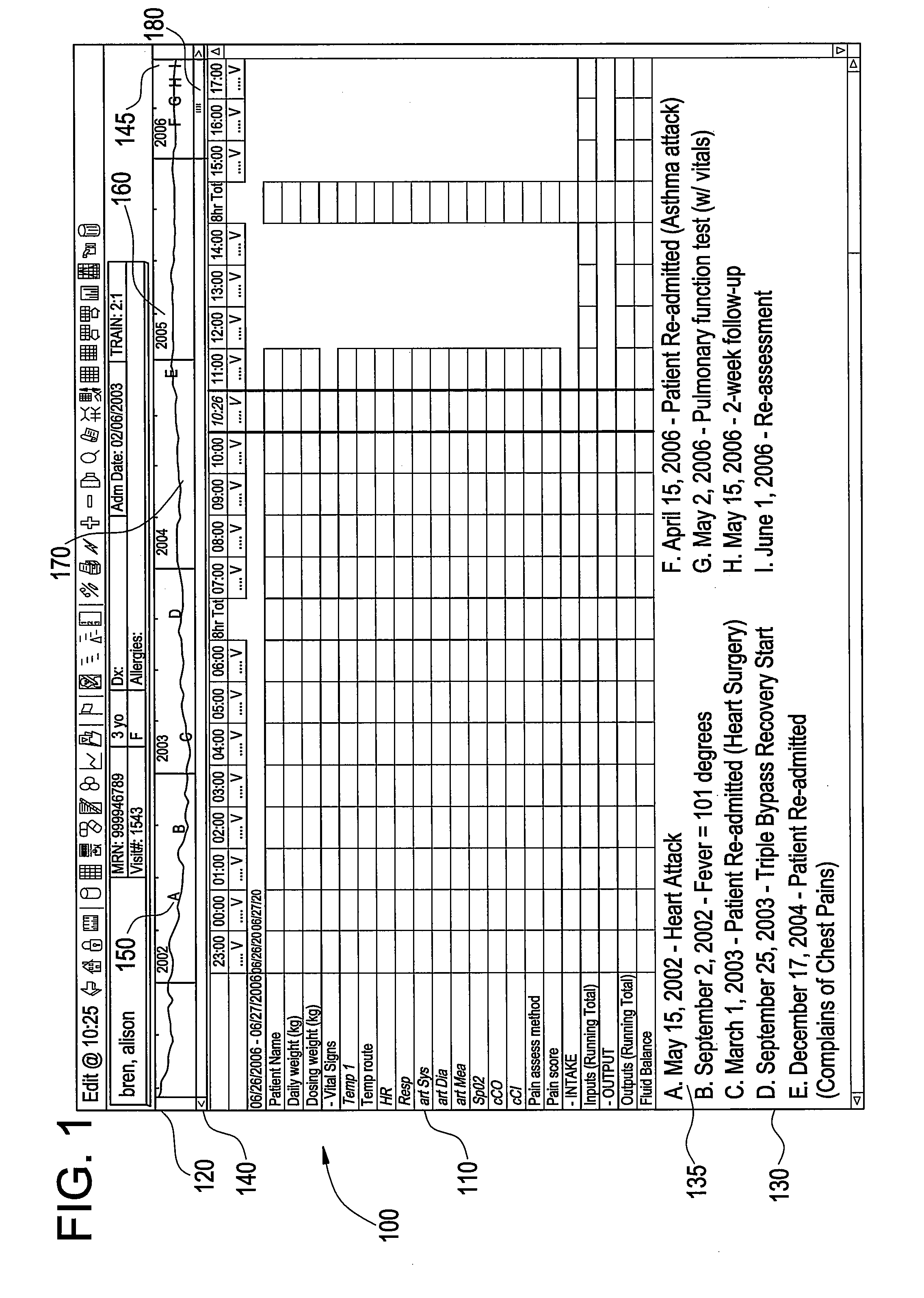 Methods and systems for navigating a large longitudinal dataset using a miniature representation in a flowsheet