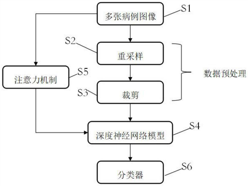 Liver case image classification method and system based on deep neural network