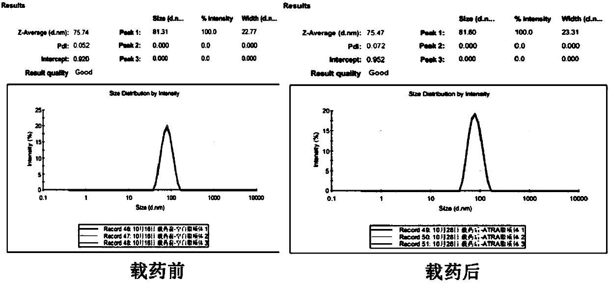 All-trans retinoic acid liposome preparation and preparation and application thereof