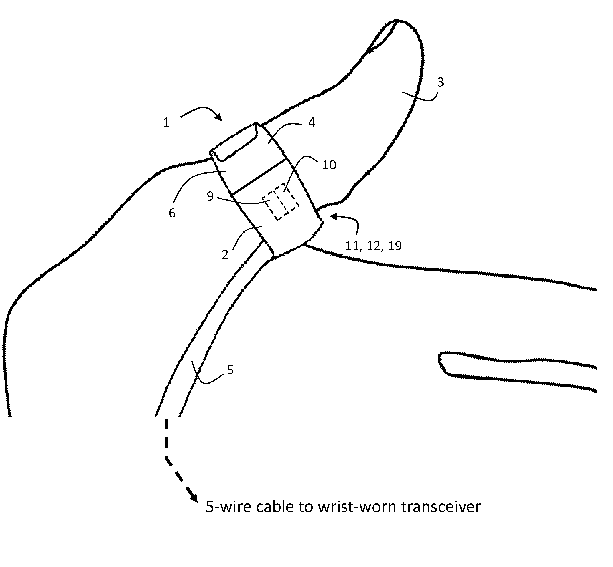 Body-worn pulse oximeter