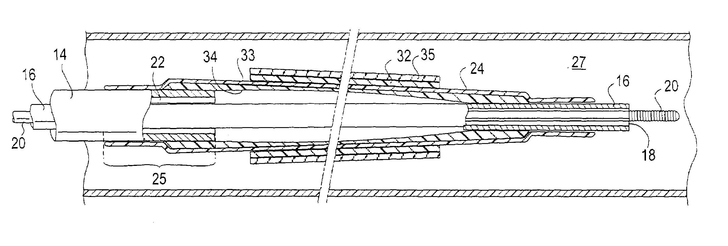 Catheter balloon liner with variable thickness and method for making same