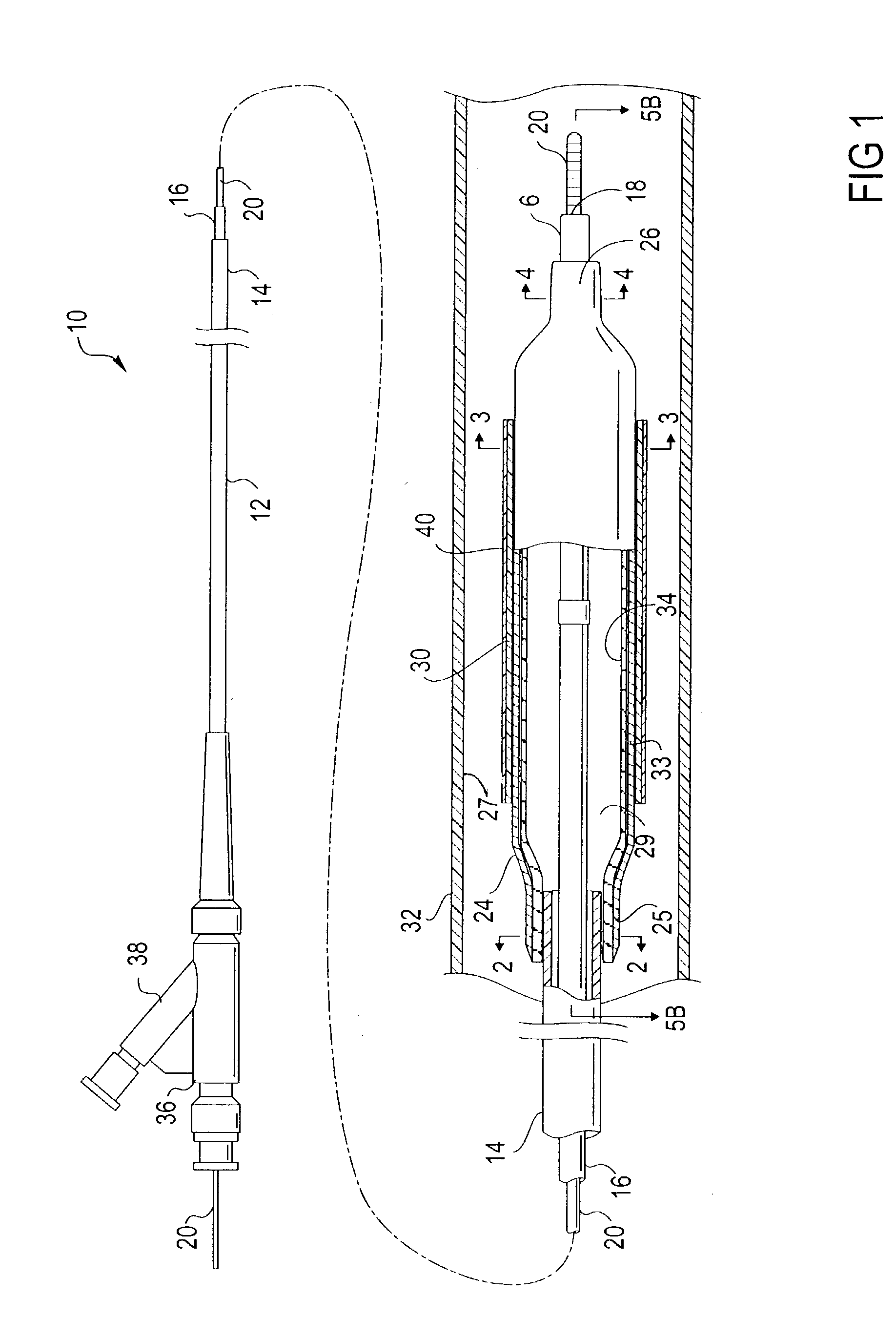 Catheter balloon liner with variable thickness and method for making same