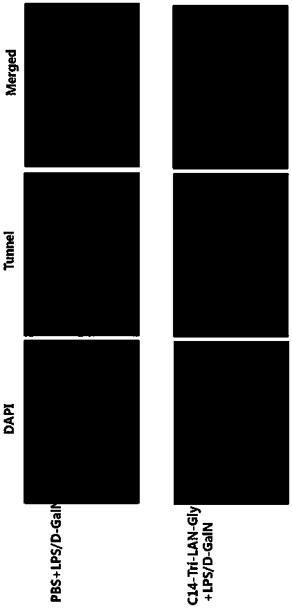 Drug for preventing and controlling fulminant hepatitis