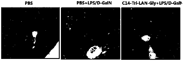 Drug for preventing and controlling fulminant hepatitis