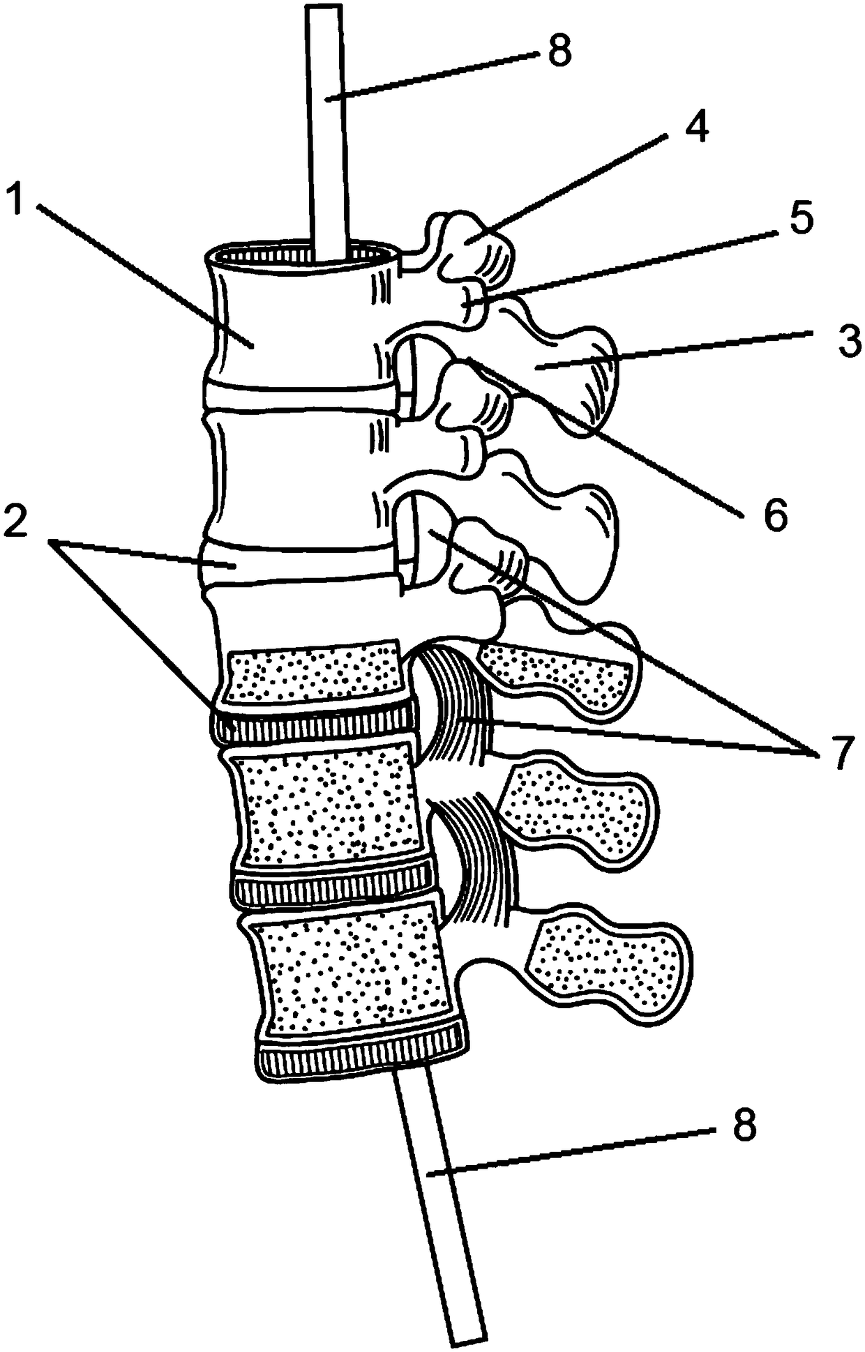 Spinal intervertebral foramen surgery model and manufacturing method thereof