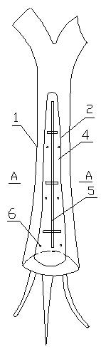 Repair method of decayed tree hole