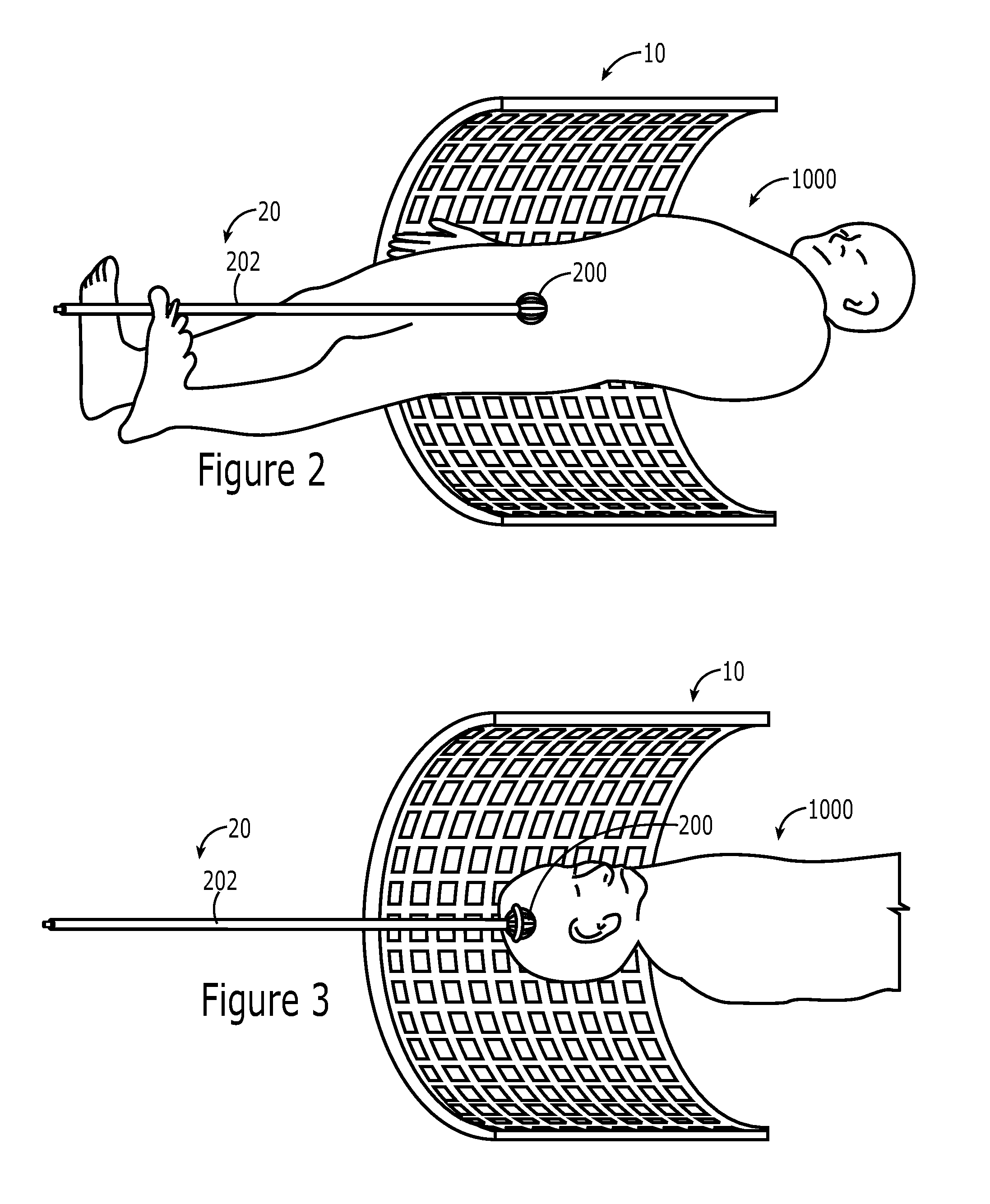 Realtime imaging and radiotherapy of microscopic disease