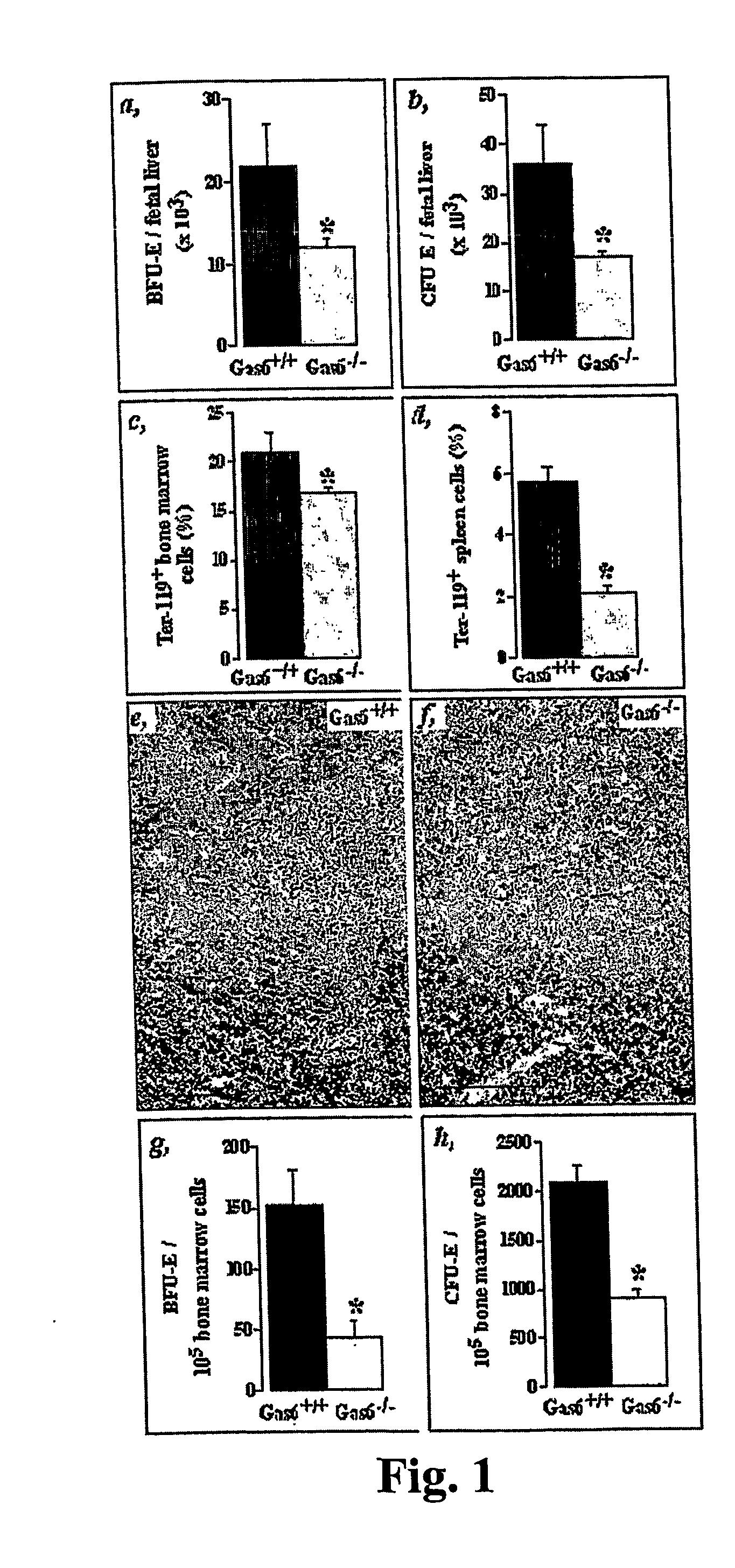 Treatment of anemia