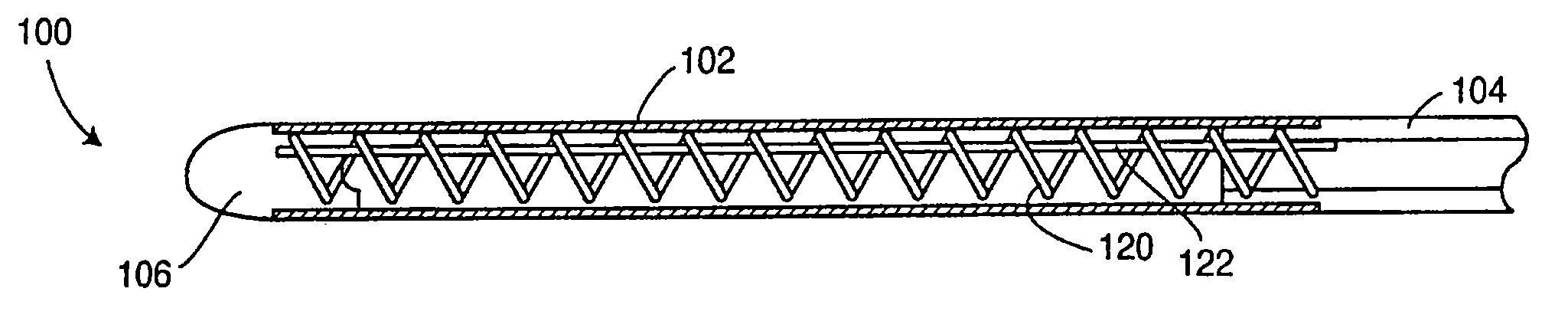 Ingrowth preventing indwelling catheter assembly