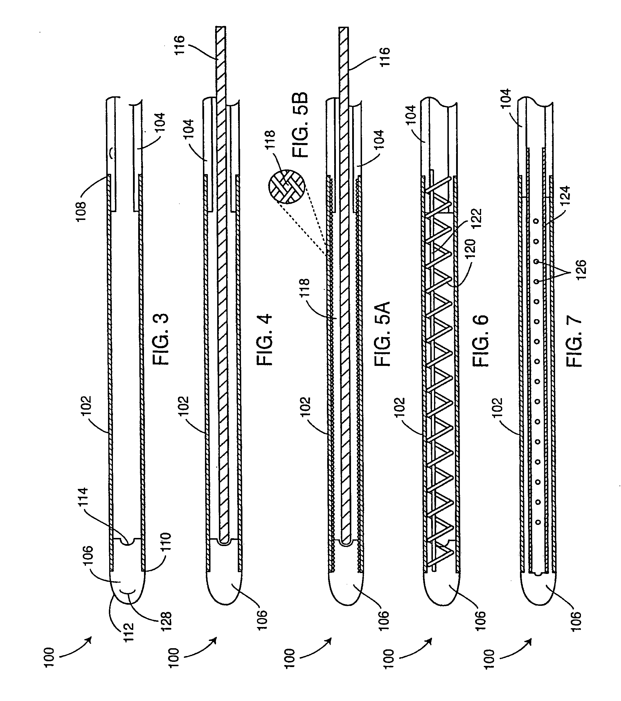 Ingrowth preventing indwelling catheter assembly