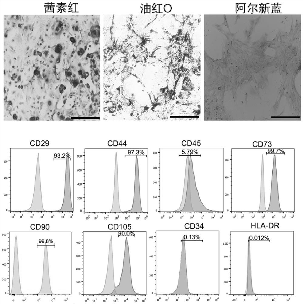 Biological agent for treating arthritis as well as preparation method and application of biological agent