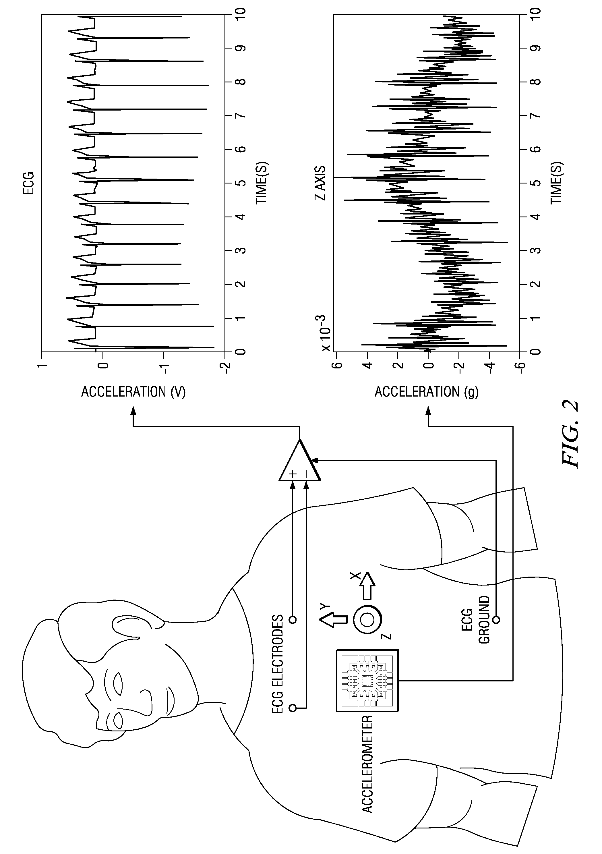 Motion/activity, heart-rate and respiration from a single chest-worn sensor, circuits, devices, processes and systems