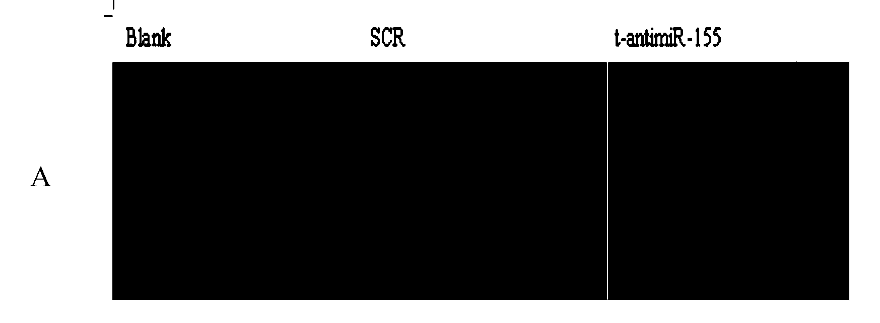 Antisense oligodeoxynucleotide for micro RNA-155 seed sequence and application