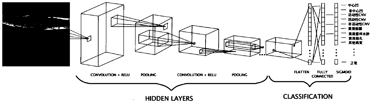 Fundus OCT image recognition method and device