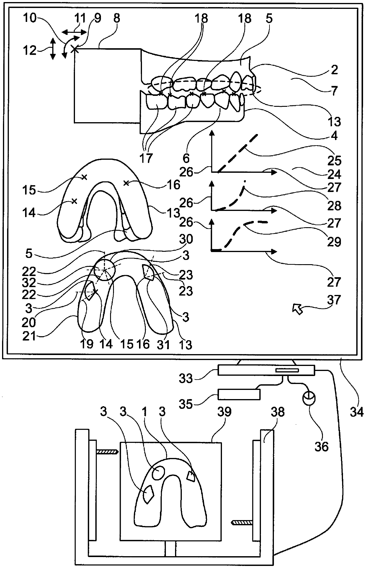 Method for producing a guided bite guard, and guided bite guard