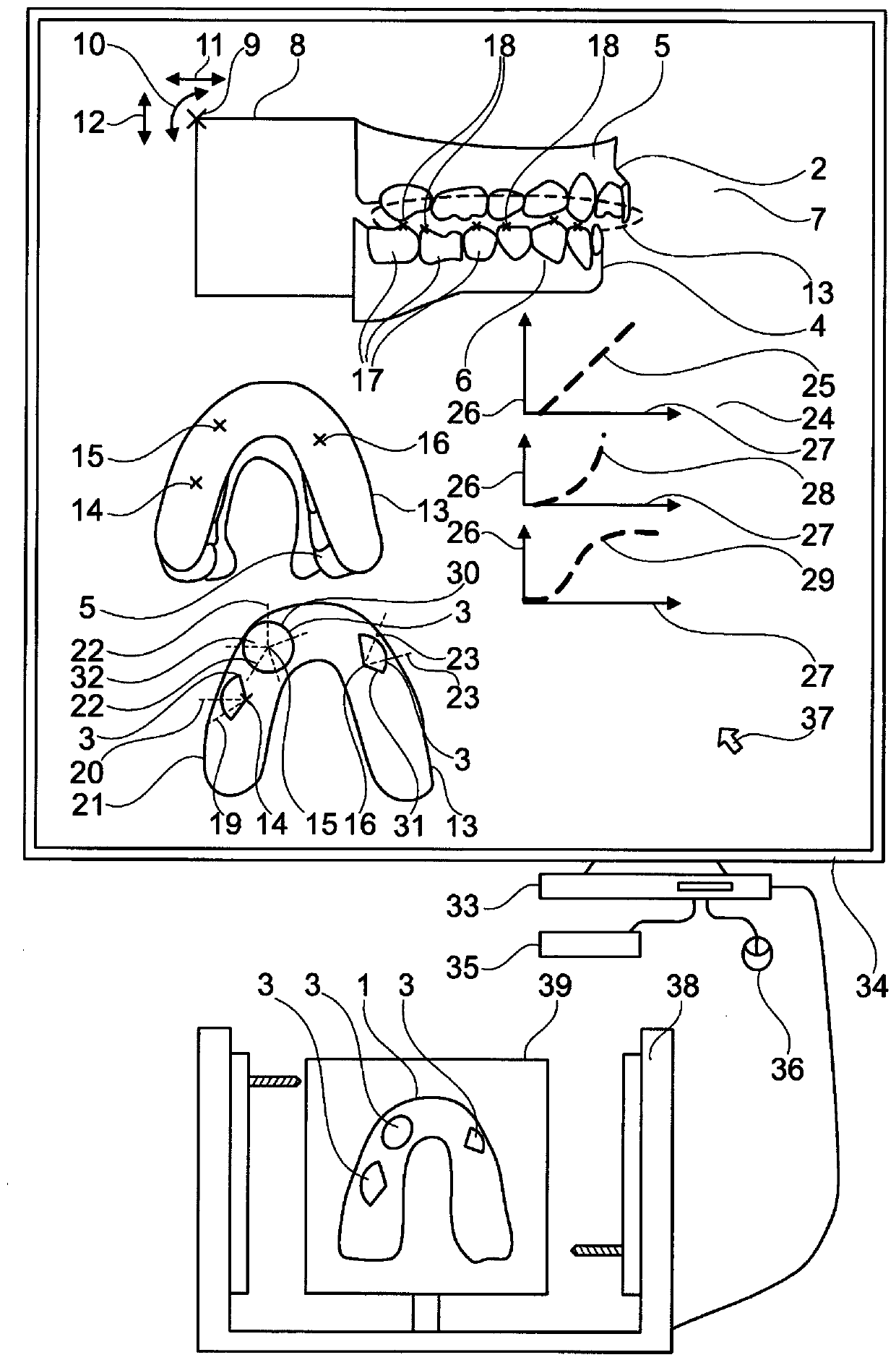 Method for producing a guided bite guard, and guided bite guard