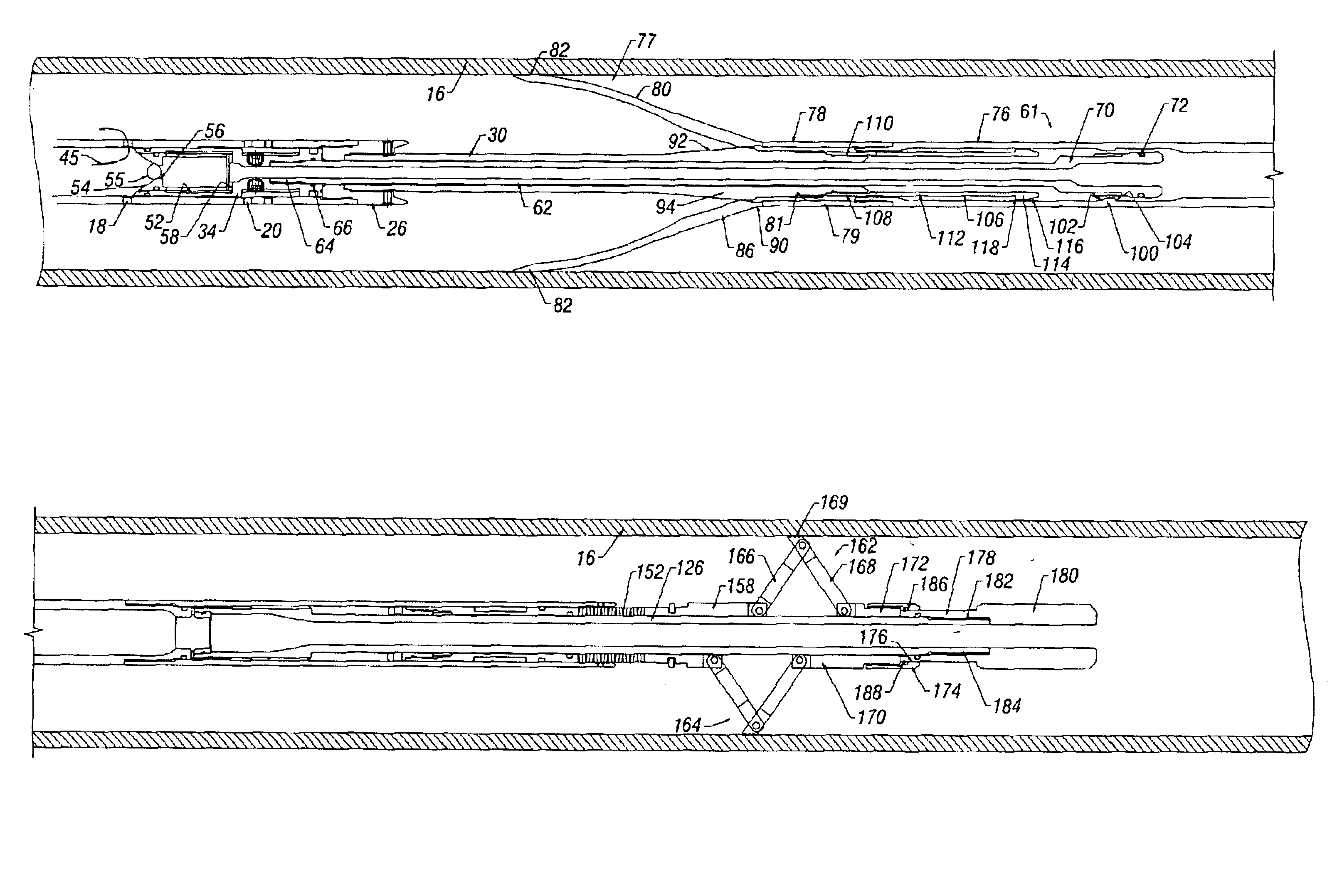 Re-enterable gravel pack system with inflate packer