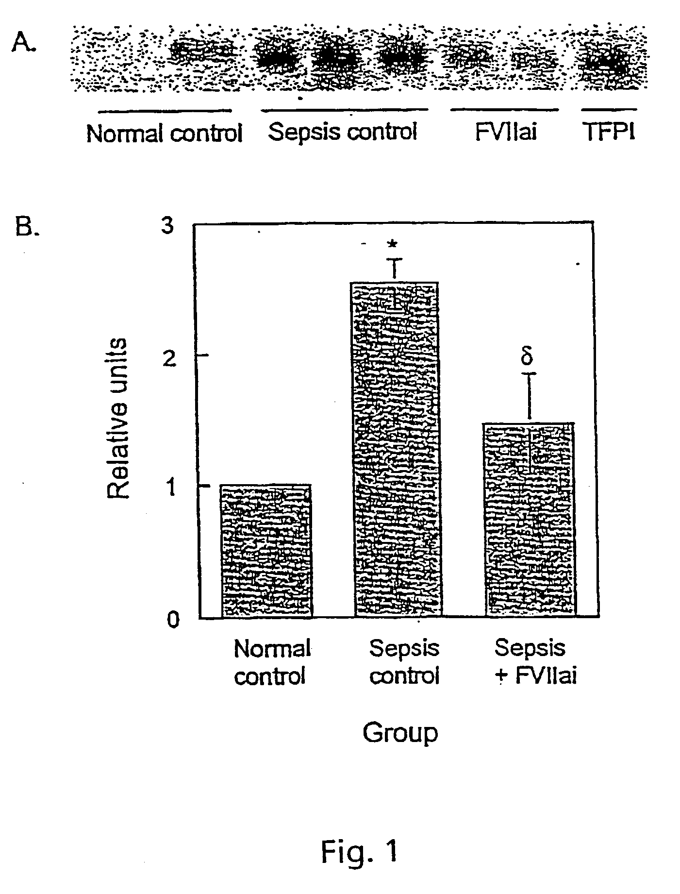 Modified FVII in treatment of ARDS