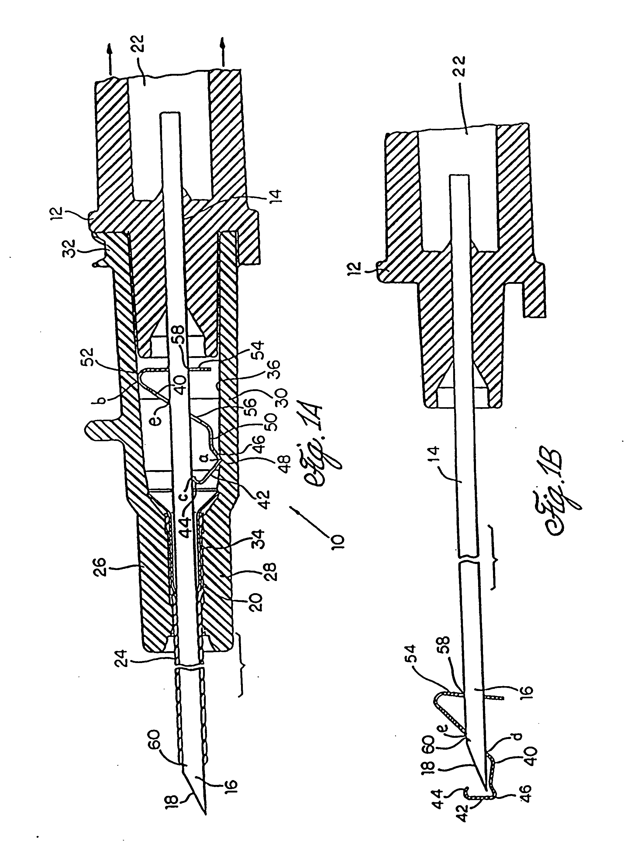 Spring clip safety IV catheter