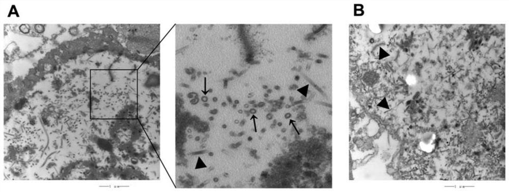 Preparation and application of type 1 bovine viral diarrhea virus virus-like particles (BVDV-VLPs)