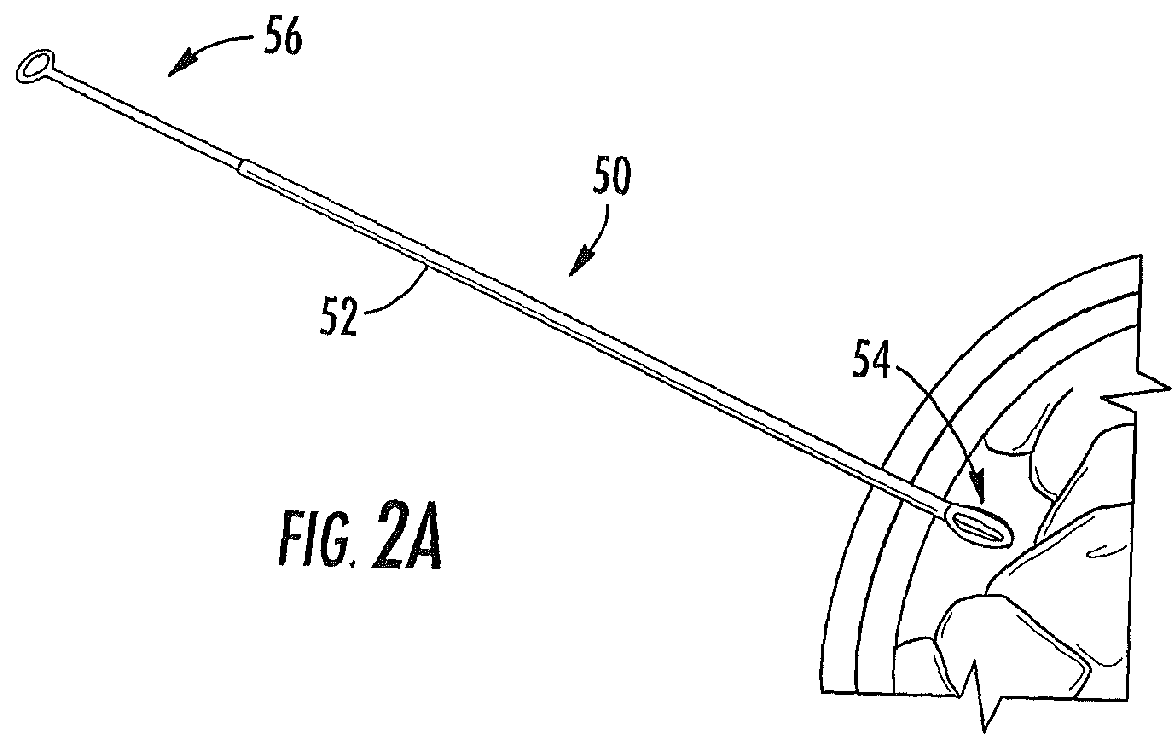 Subdural drainage catheters with self contained mechanism for restoration of flow following catheter obstruction