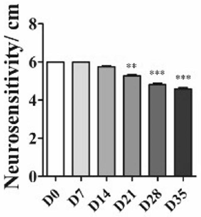 Application of rhfgf-21 in preparation of medicine for treating dry eye syndrome