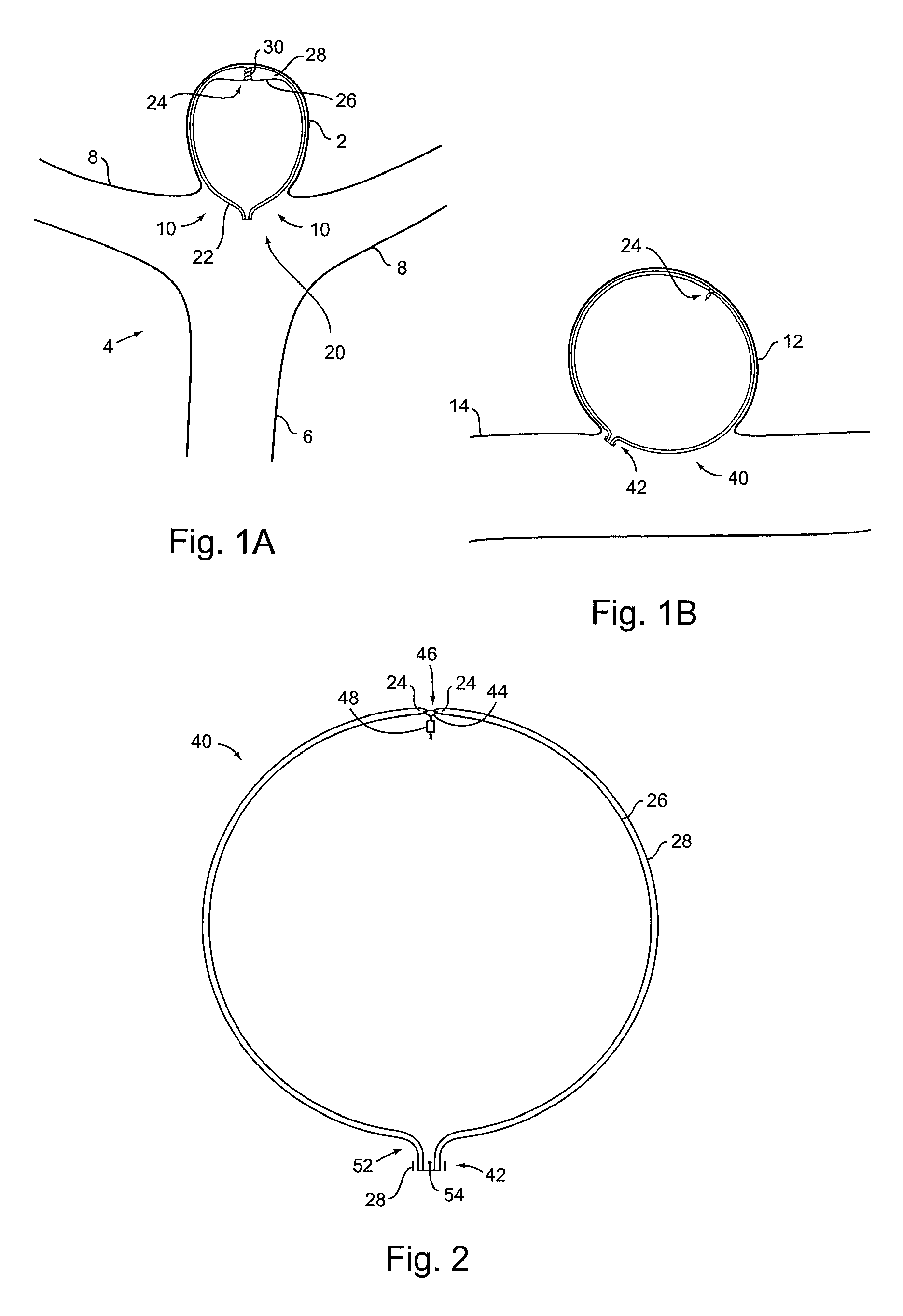 Braid-Ball Embolic Devices