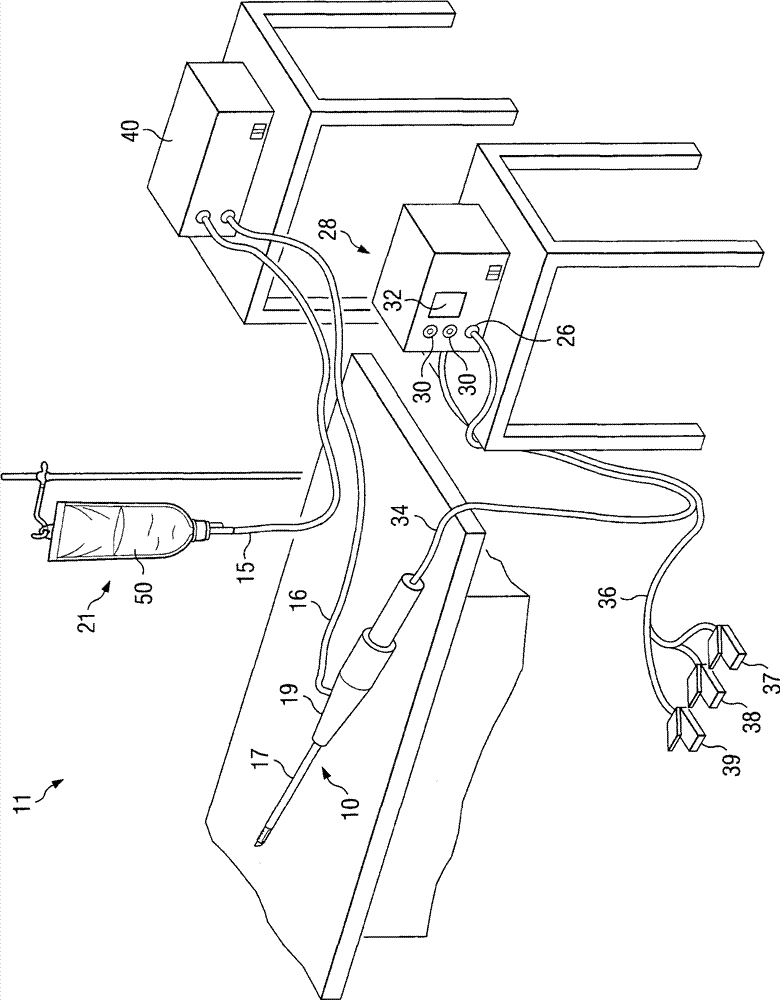 Systems and methods for turbinate reduction