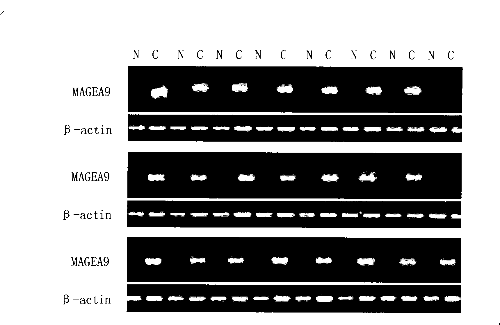 Uses of MAGEA9 gene