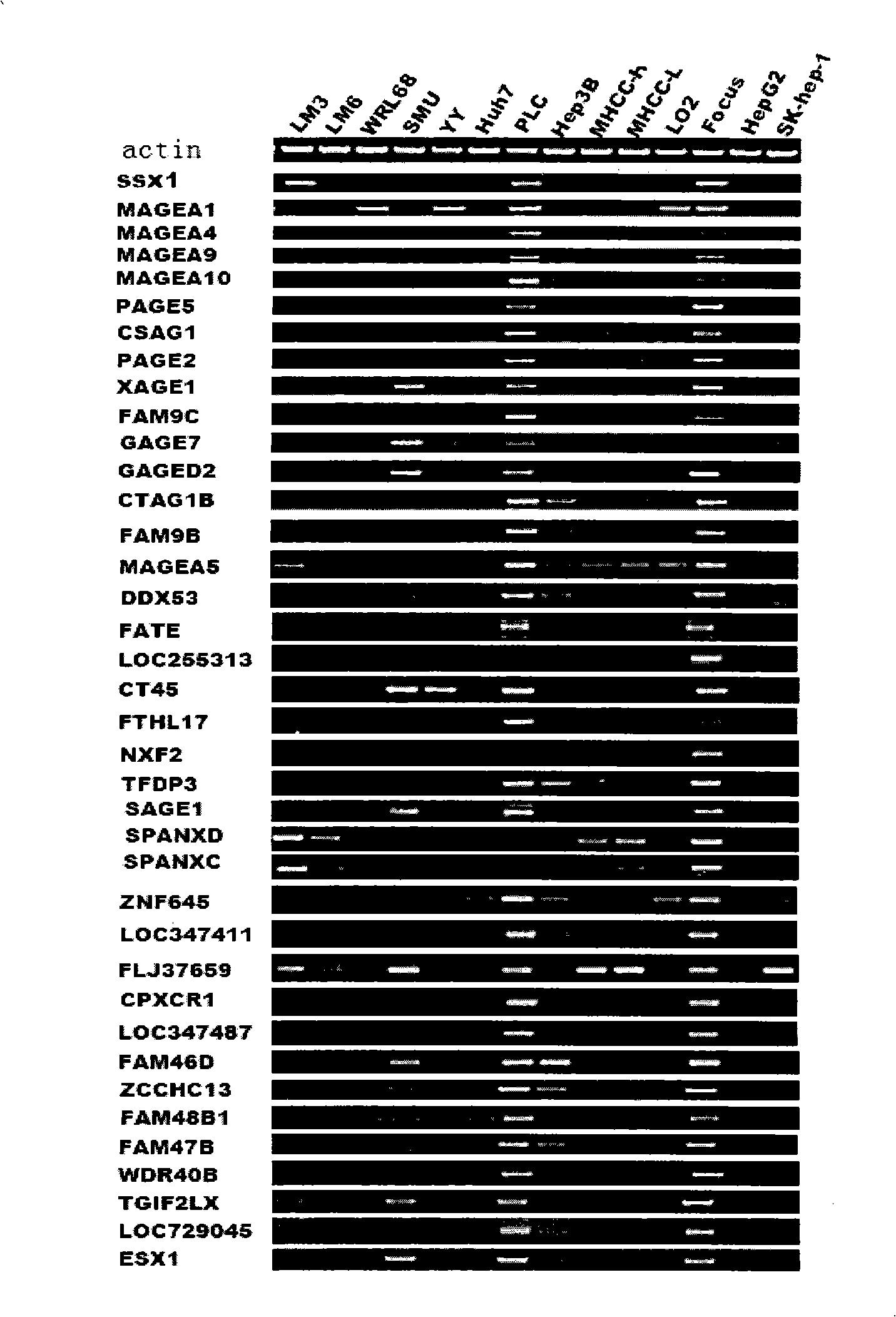 Uses of MAGEA9 gene